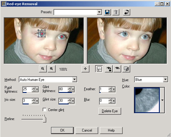 Рис. 33. Настройка параметров Red-Eye Removal